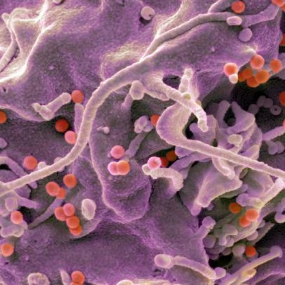 Vacinas de mRNA contra HIV geram forte resposta imunológica em humanos