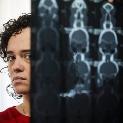Síndrome da fadiga crônica provoca cansaço extremo e afeta qualidade de vida