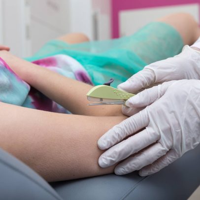Implanon será disponibilizado no SUS como novo método contraceptivo ainda este ano