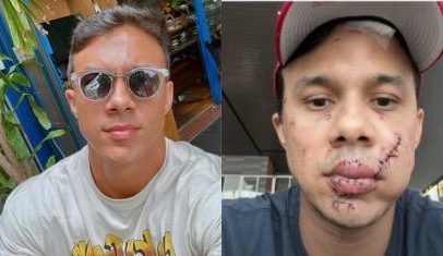 Homem admite ter desfigurado personal trainer em ataque no interior de SP