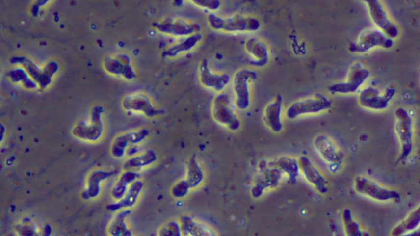 Ameba Naegleria fowleri, conhecida como 'comedora de cérebros' (Foto: Reprodução Centros de Controle e Prevenção de Doenças - CDC)