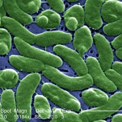Aumentam os casos de mortes por bactéria 'comedora de carne' nos Estados Unidos