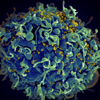 Vacinas de RNAm contra HIV mostram forte resposta imune em novo estudo