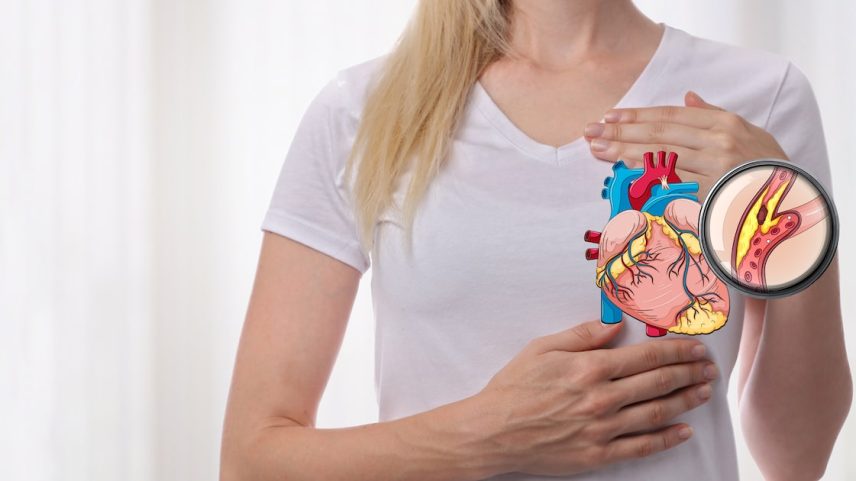Existem três grandes causas por trás dos altos níveis de LDL: genética, alimentação e doenças pré-existentes. (Foto: Adobe Stock)