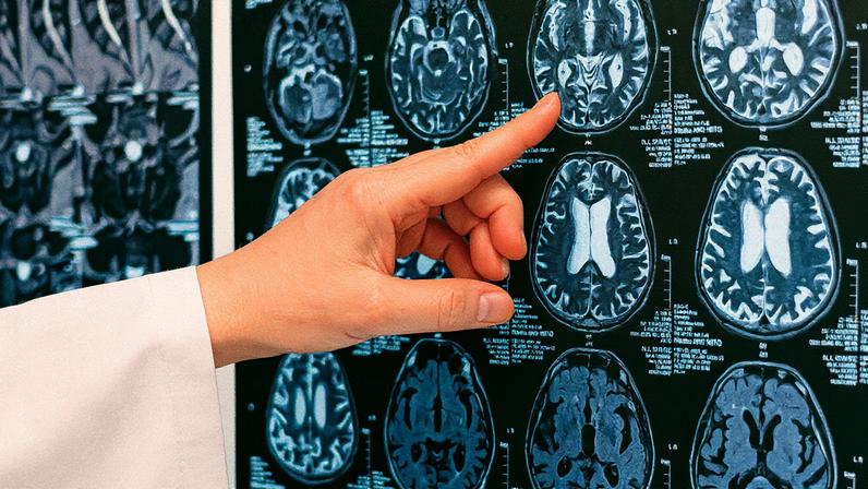 Modelo desenvolvido por pesquisadores consegue entender como a metástase se comporta (Foto: Anna Shvets/Pexels)