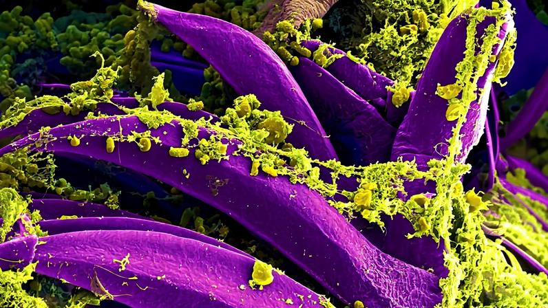 Peste é uma doença infecciosa causada pela bactéria Yersinia pestis. (Foto: NIH)