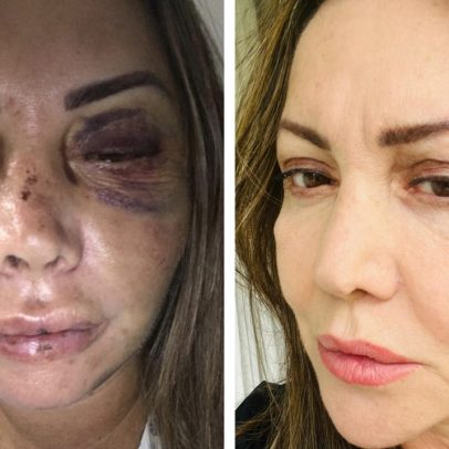 Mulher espancada no Rio se choca ao saber de agressão brutal em Natal