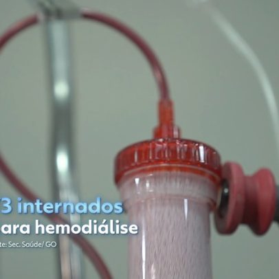 Sistema de saúde enfrenta colapso na hemodiálise e gera internações desnecessárias