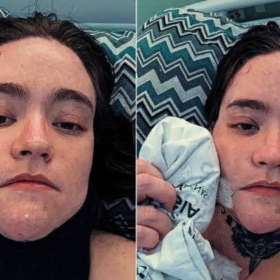 Jovem com dor intensa será tratado com cetamina para 'reiniciar' cérebro