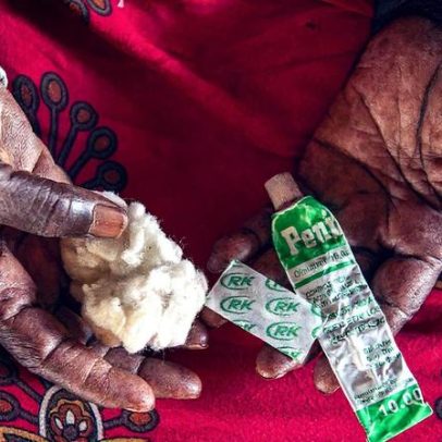Morte de bebê na Gâmbia impulsiona discussão sobre mutilação genital feminina