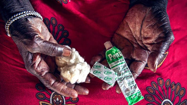 Yassin Fatty, que pratica a mutilação genital feminina, com as ferramentas que usa para o procedimento, em Wassu, na Gâmbia - 13.nov.24 (Foto: Kiana Hayeri/The New York Times)