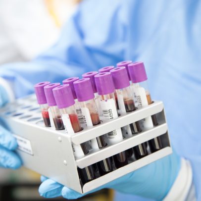 OMS classifica vírus da hepatite D como cancerígeno, igual ao HPV