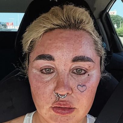 Amanda Bynes exibe novo visual após procedimento estético nos lábios