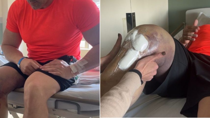 Daniel Silveira em sessão de fisioterapia após cirurgia na perna (Foto: Reprodução)