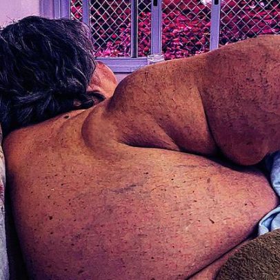Aposentada vive há quase 5 anos em hospital de São Paulo em busca de cuidados