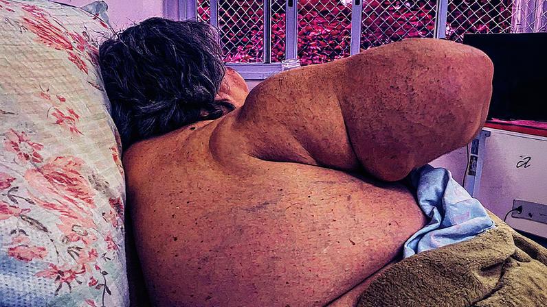 A aposentada Ana Lúcia Martins, 66, que vive há quase cinco anos internada no Conjunto Hospitalar do Mandaqui, na zona norte de São Paulo (Foto: Rafaela Araújo/Folhapress)