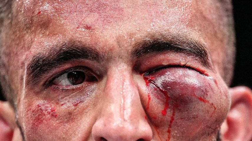 Mohammad Yahya fica com olho inchado após derrota no UFC (Foto: Chris Unger/Zuffa LLC)