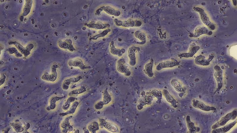 Ameba Naegleria fowleri, conhecida como 'comedora de cérebros' (Foto: Reprodução Centros de Controle e Prevenção de Doenças - CDC)