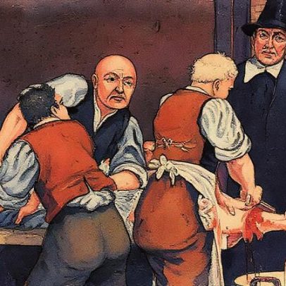 Cirurgião Joseph Lister transforma a Medicina e inspira marcas como Listerine