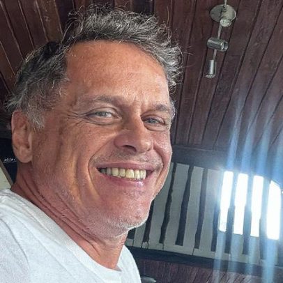 Guilherme Fonte se prepara para novas cirurgias após operar os ouvidos