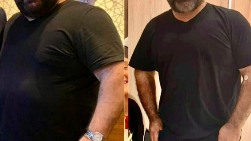 Antes e depois do cantor (Foto: Reprodução/Fabiano)