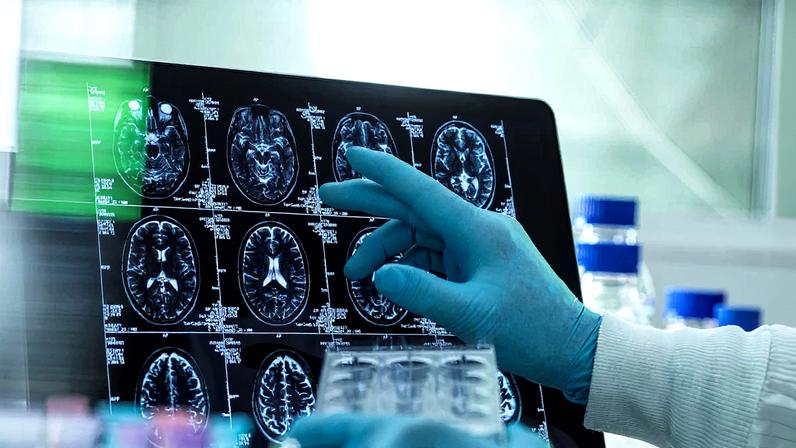 Um cientista frente a escâneres cerebrais. (Foto: TEK IMAGE/SCIENCE PHOTO LIBRARY)