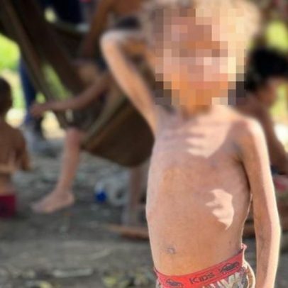 Aquecimento global pode aumentar mortes por diarreia em crianças, aponta estudo