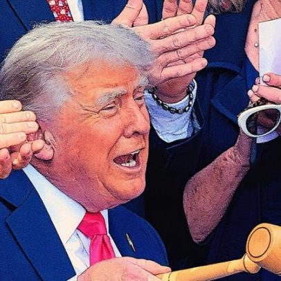 Insuficiência venosa crônica é diagnosticada em Donald Trump