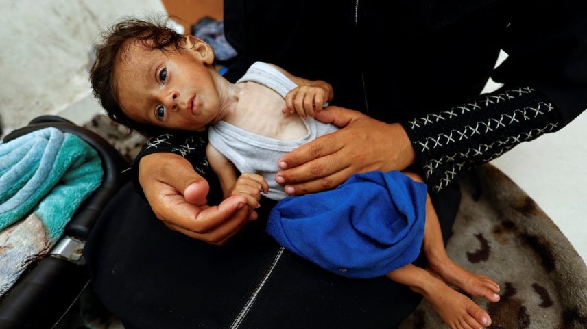 Ammar, de cinco meses, em um hospital de Gaza. (Foto: Mahmoud Issa/REUTERS)