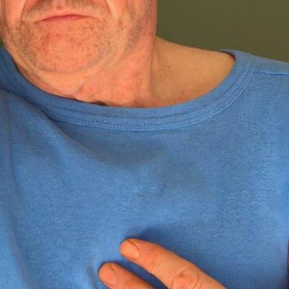 Dor no peito pode indicar infarto, mas nem sempre é o caso