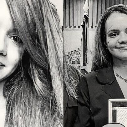 Juliana celebra renascimento após sobreviver a 61 socos em ataque brutal