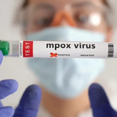 África registra quase 50 mil casos confirmados de mpox em recente surto