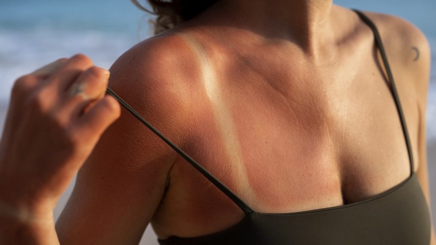Justiça mantém justa causa de mulher que fez bronzeamento artificial durante atestado (Foto: Reprodução Freepik)