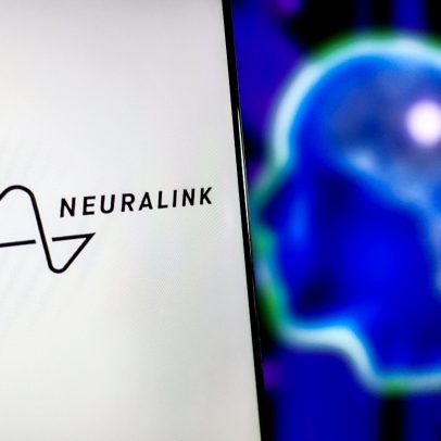 Neuralink inicia estudo clínico no Reino Unido para testar chips em pacientes com paralisia