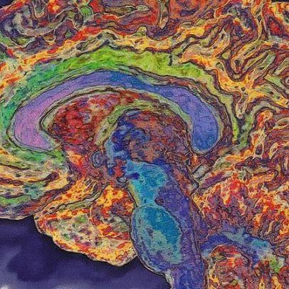 Implante cerebral lê mentes e garante proteção com senha para segurança