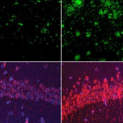 Lítio pode ser a chave para entender e tratar Alzheimer, aponta estudo de Harvard