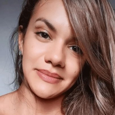 Mulher agredida com 61 socos recebe alta após cirurgia de reconstrução facial