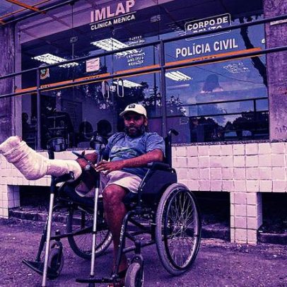 Entregador ferido por policial penal em Jacarepaguá relata dor com bala no pé