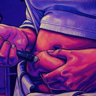 Médicos pedem inclusão de canetas emagrecedoras no SUS para combater obesidade