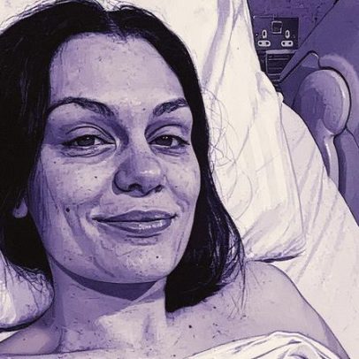Jessie J adapta show no The Town em função do tratamento contra câncer de mama