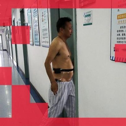 Ferramenta de IA chinesa promete transformar o tratamento de doenças crônicas