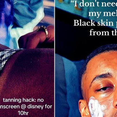 Geração Z rejeita protetor solar em nome do meio ambiente e gera polêmica