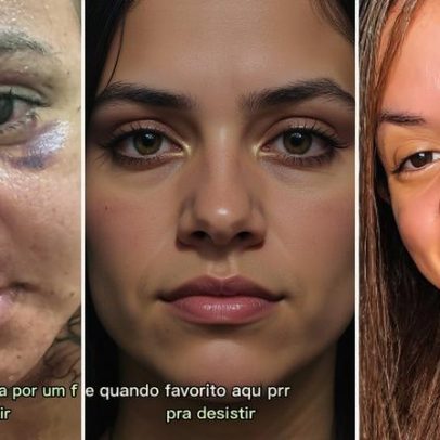 Mulher agredida com 61 socos mostra progresso na recuperação após cirurgia facial