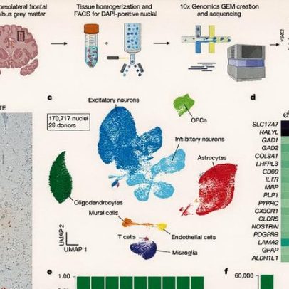 Traumas repetidos na cabeça causam perda de neurônios em jovens atletas