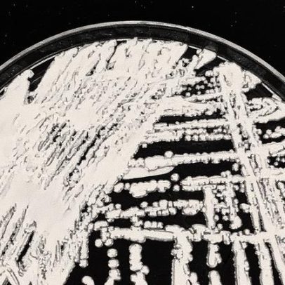 Europa emite alerta sobre fungo resistente a tratamentos médicos