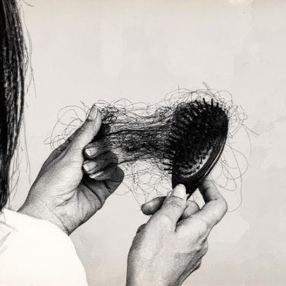 Estudo revela que estigma da alopecia areata afeta mais que a doença em si