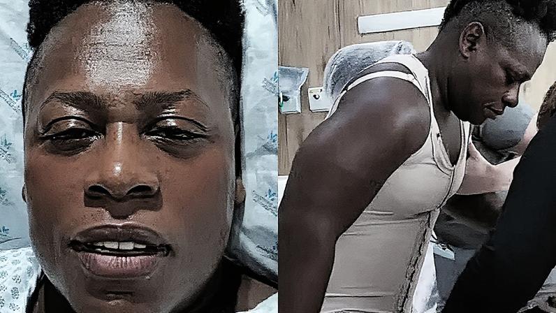 Cantora Neném passa por combo de cirurgias plásticas (Foto: Reprodução)