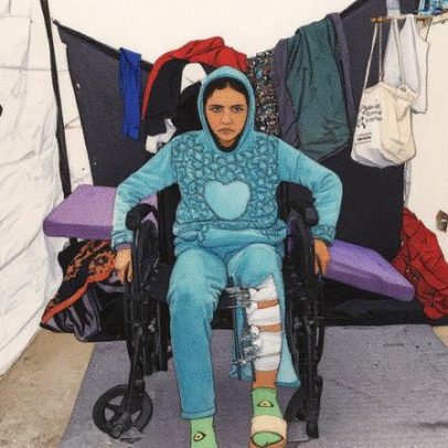 Guerra em Gaza deixa 21 mil crianças com deficiência e 40 mil feridas