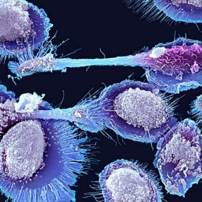 Célula imunológica recém-descoberta em camundongos revela causa da inflamação na idade avançada