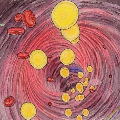 Nova diretriz estabelece metas mais rigorosas para controle do colesterol
